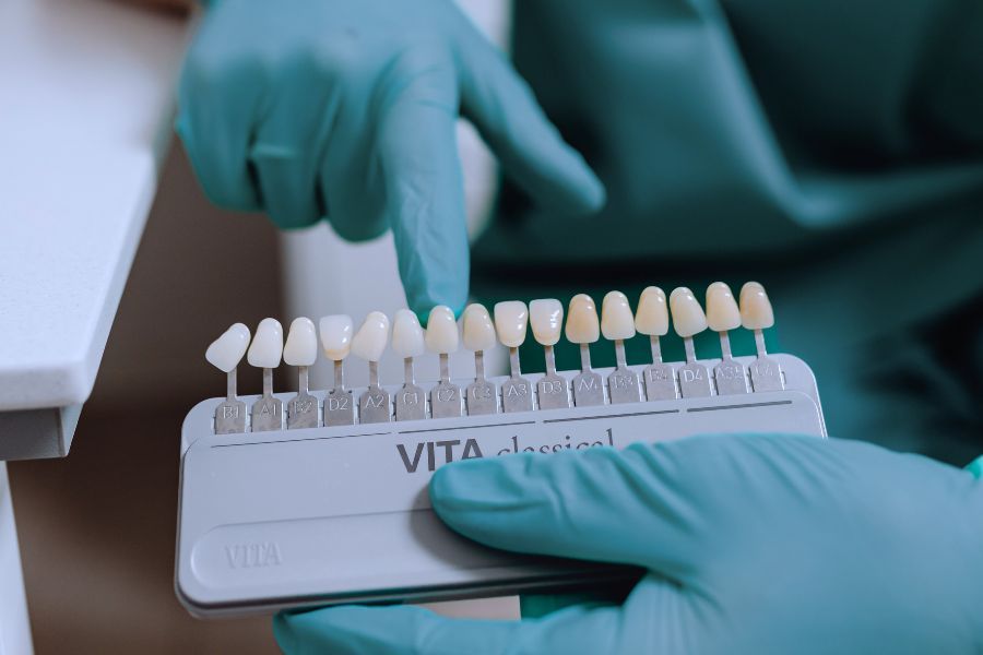 Bild zu Herstellung & Einsetzen - So läuft die Veneer-Behandlung bei Dr. Petry & Tuschen in Bad Soden ab