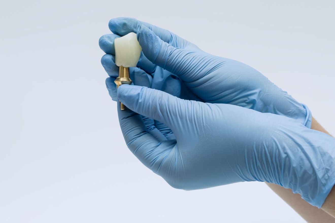 Bild zu Zahnersatz für langfristig stabile Zähne von Zahnarzt Bad Soden Dr. Petry & Tuschen